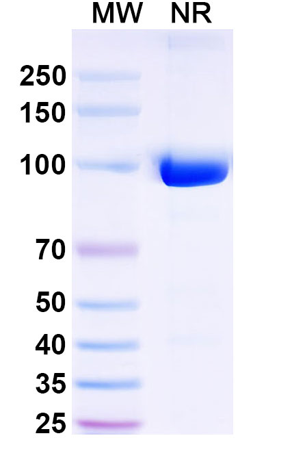 SDS-PAGE for Anti-Listeria monocytogenes serovar 1/2a InlB/Internalin B Antibody (SAA0363)