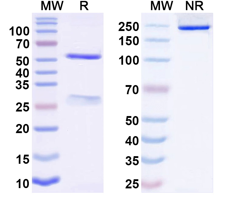 SDS-PAGE for Anti-LRRK1 Monoclonal Antibody (N341/12)