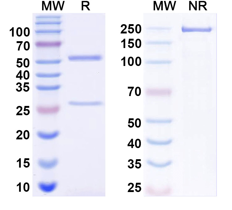 SDS-PAGE for Anti-LRRK2/Dardarin Antibody (1D8)