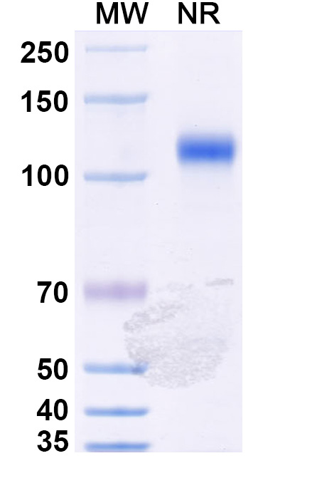 SDS-PAGE for Anti-Mal f 1/Allergen Pit o 1 Antibody (SAA0649)