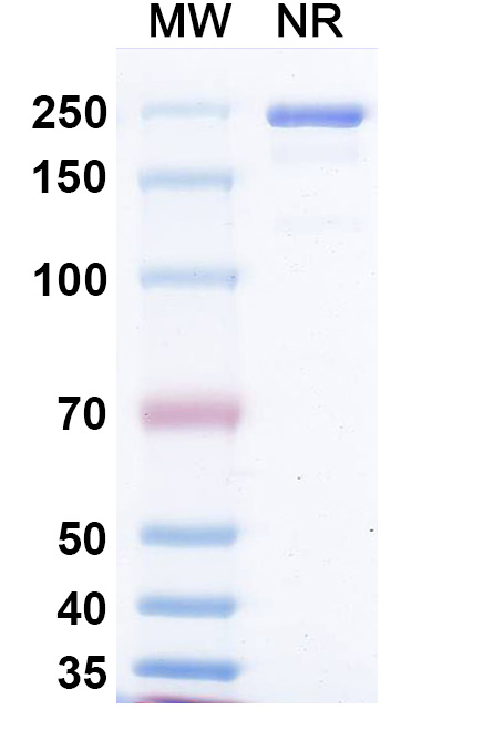 SDS-PAGE for Anti-Measles virus/MeV F/Fusion Antibody (mAb 77)