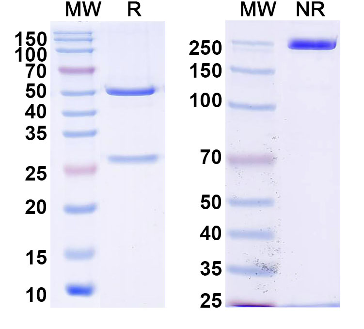 SDS-PAGE for Anti-Mouse latent TGFB1/TGF-beta-1 Antibody (SAA2433)