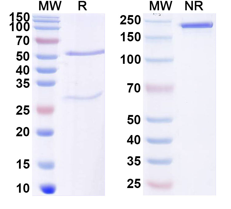 SDS-PAGE for Anti-Mouse ZNF423 Antibody (N328B/37R)