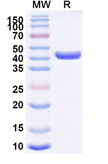 SDS-PAGE for Anti-MPXV A29L Antibody (P1E2)