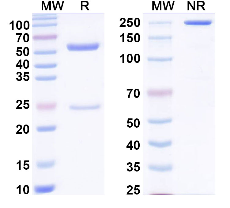 SDS-PAGE for Anti-Mycobacterium tuberculosis katG Antibody (ABS1958)