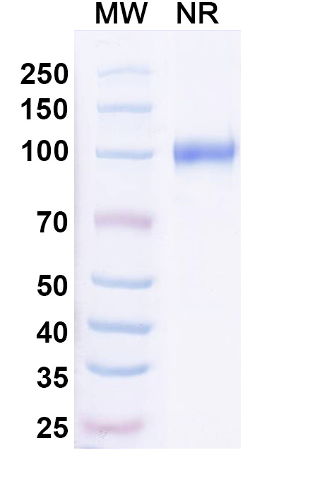 SDS-PAGE for Anti-Neisseria meningitidis NadA/Neisseria adhesin A  Antibody (G9)