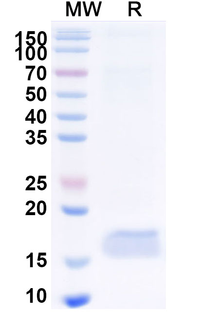 SDS-PAGE for Anti-Oropouche virus/OROV Glycoprotein G1 VHH Antibody (SAA2267)