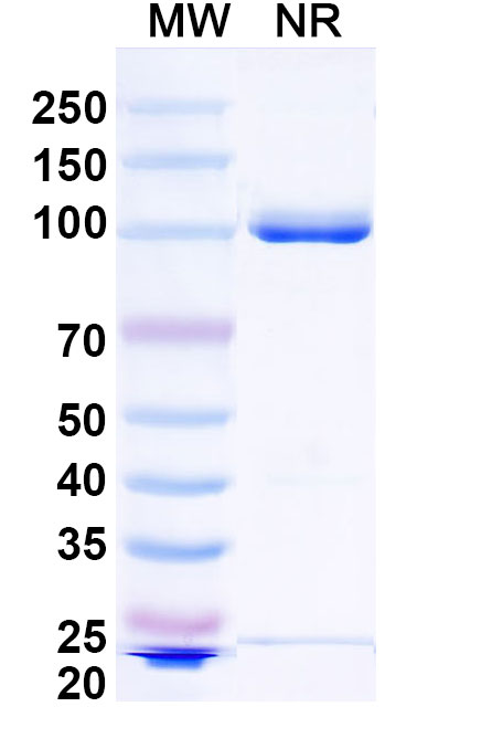 SDS-PAGE for Anti-Oropouche virus/OROV Glycoprotein G1 VHH Antibody (SAA2560)