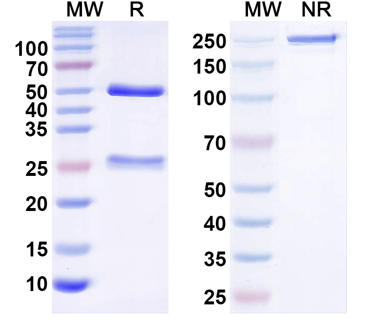 SDS-PAGE for Anti-P.gingivalis fimA/Fimbrilin VHH (123-123-10)