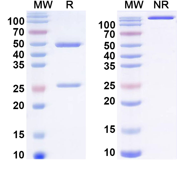 SDS-PAGE for Anti-pan-coronavirus neutralization Antibody (76E1)