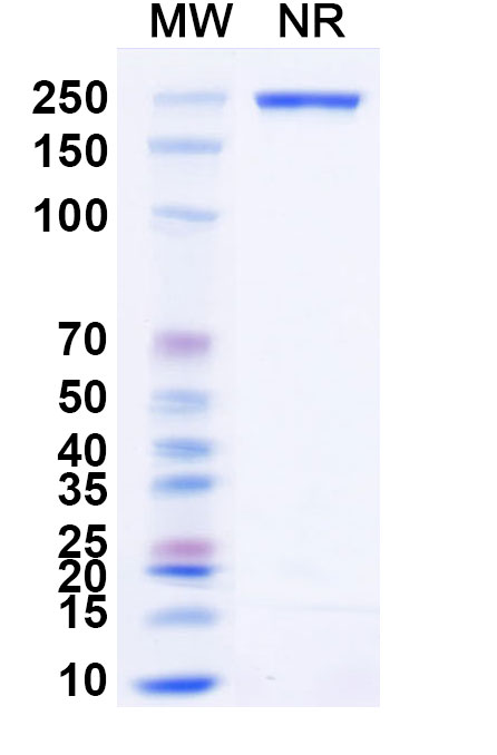 SDS-PAGE for Anti-Phleum pratense PHLPII/Phlp2 Antibody (HuMab2)