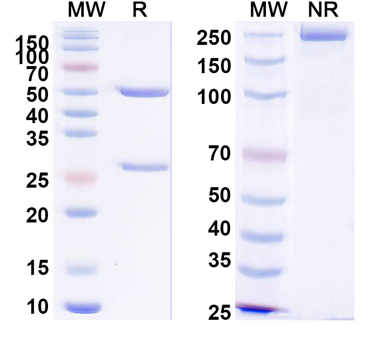 SDS-PAGE for Anti-PHLPV/Allergen Phl p V Antibody (SAA0710)