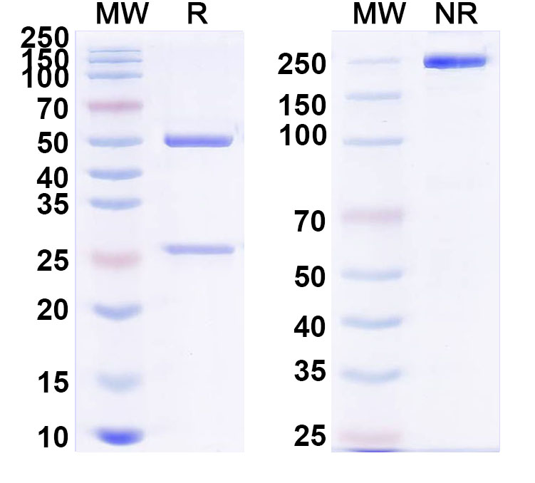 SDS-PAGE for Anti-PHLPV/Allergen Phl p V Antibody (SAA0721)