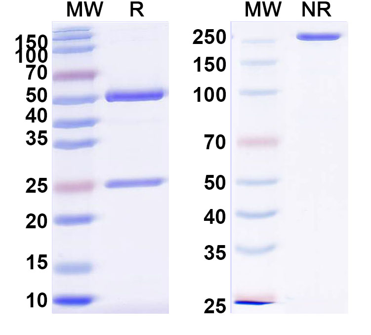 SDS-PAGE for Anti-PHLPV/Allergen Phl p V Antibody (SAA0726)
