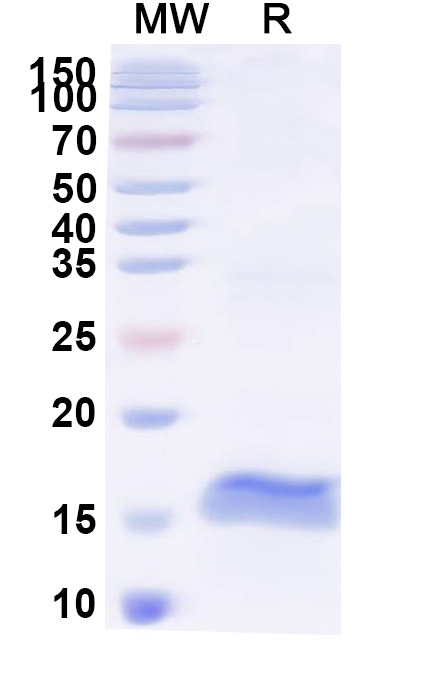 SDS-PAGE for Anti-Pig Pancreatic alpha-amylase/AMY2 VHH (SAA2257)