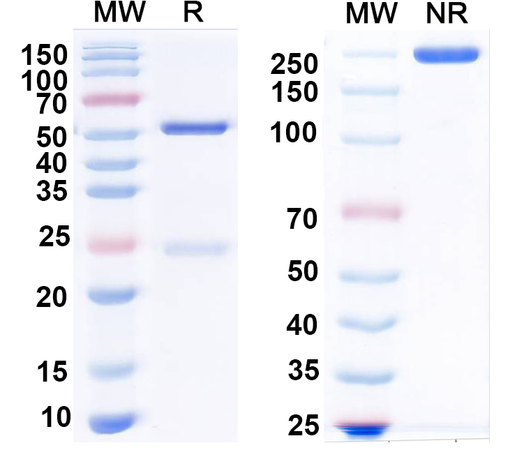 SDS-PAGE for Anti-PIGA Antibody (N462/13)