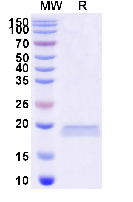 SDS-PAGE for Anti-Pityrosporum furfur Mal f 1/Allergen Pit o 1 VHH (SAA1212)