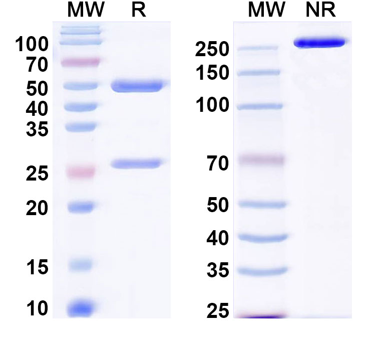 SDS-PAGE for Anti-Plasmodium falciparum MSA2/MSP2 Antibody (6D8)