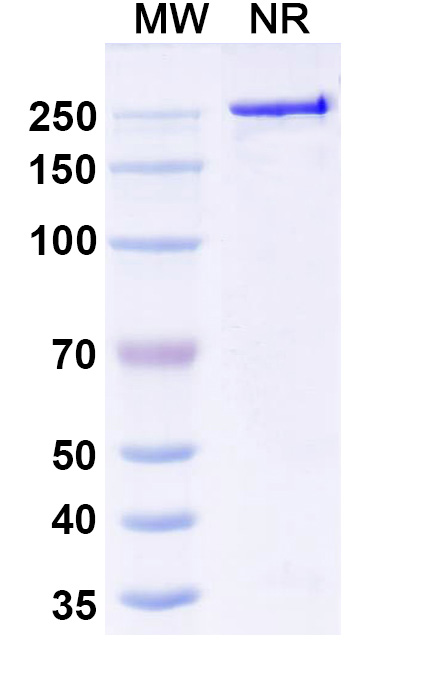 SDS-PAGE for Anti-polyglutamine/polyQ Antibody (1C2)