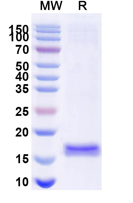 SDS-PAGE for Anti-Porphyromonas gingivalis VHH (SAA1181)