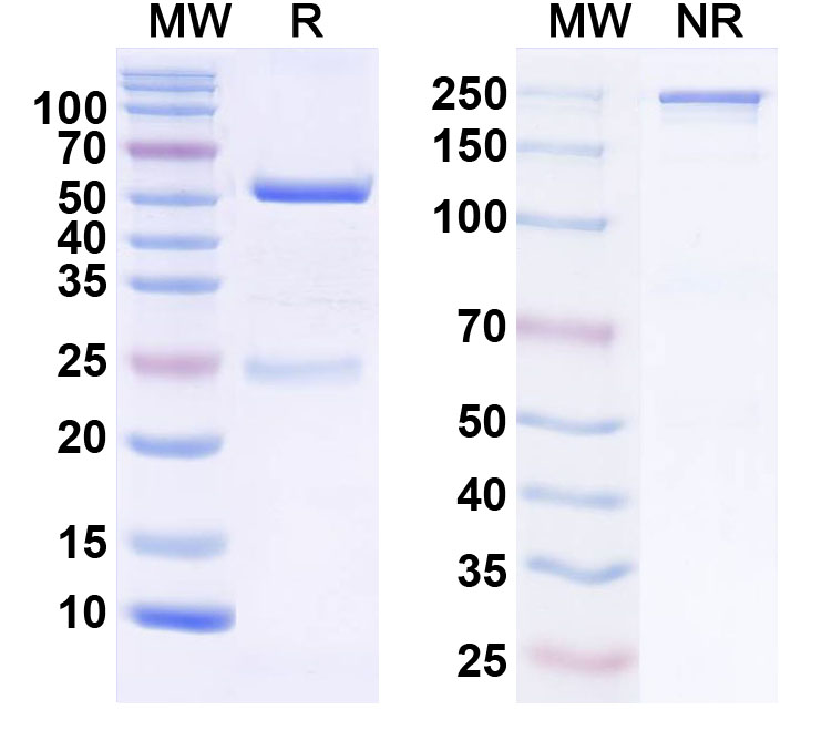 SDS-PAGE for Anti-POTRA domain-containing protein/OMP Antibody (SAA2421)
