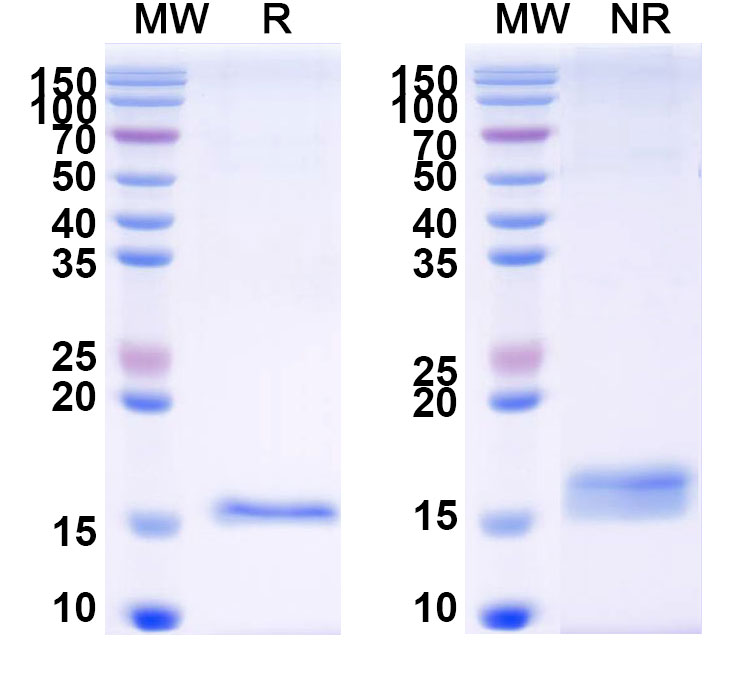 SDS-PAGE for Anti-PRRSV RNA-directed RNA polymerase/NSP9 VHH (Nb8)