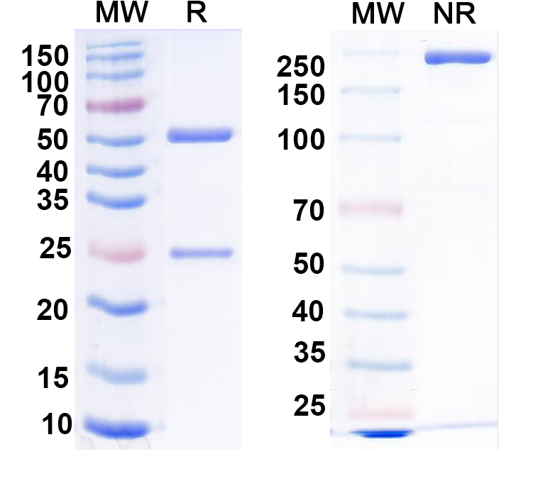 SDS-PAGE for Anti-RABV G/Glycoprotein Antibody (EP5G3)