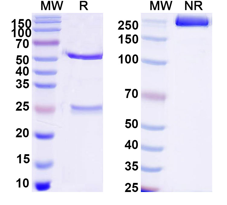 SDS-PAGE for Anti-Rat CD26/DPP4 Antibody (SAA1395)