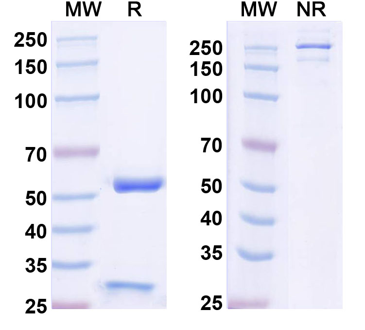 SDS-PAGE for Anti-RBM17/SPF45 Antibody (N219/16)