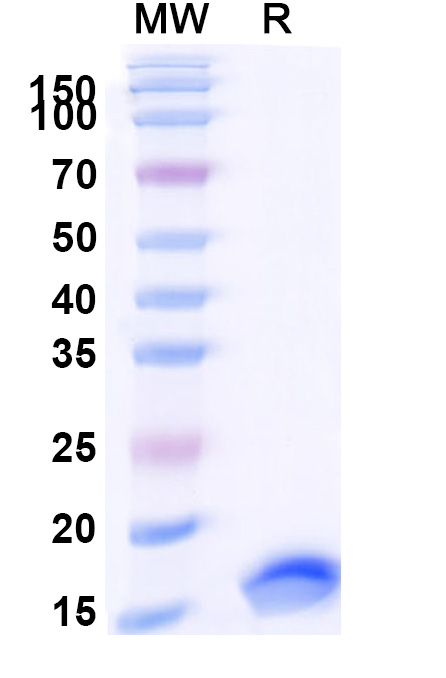SDS-PAGE for Anti-SARS-CoV-2 S Protein VHH (SAA0885)