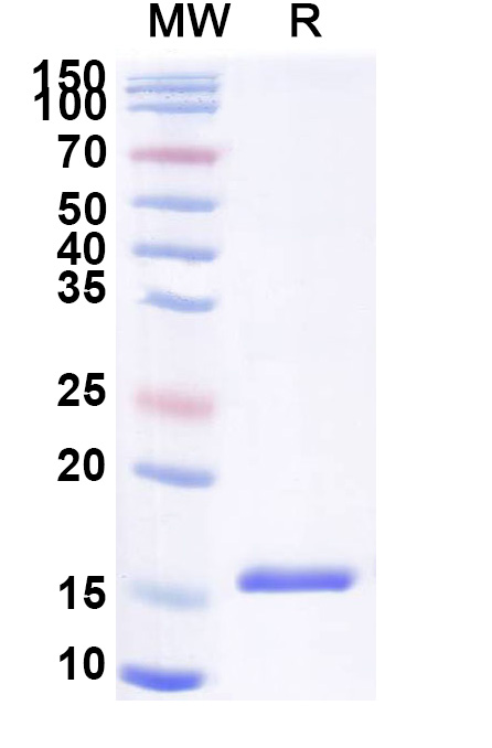 SDS-PAGE for Anti-SARS-CoV-2 S Protein VHH (SAA0893)