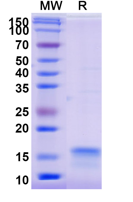 SDS-PAGE for Anti-SARS-CoV-2 S Protein VHH (SAA0913)