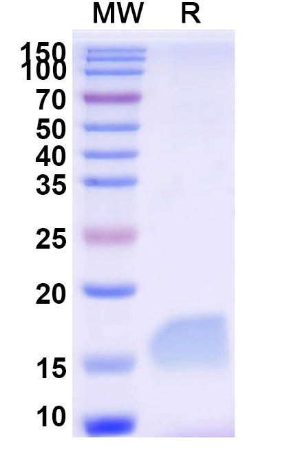 SDS-PAGE for Anti-SARS-CoV-2 S Protein VHH (SAA0949)