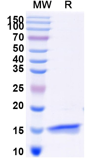 SDS-PAGE for Anti-SARS-CoV-2 S Protein VHH (SAA0950)