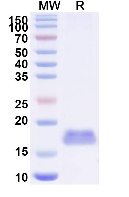 SDS-PAGE for Anti-SARS-CoV-2 S Protein VHH (SAA0956)