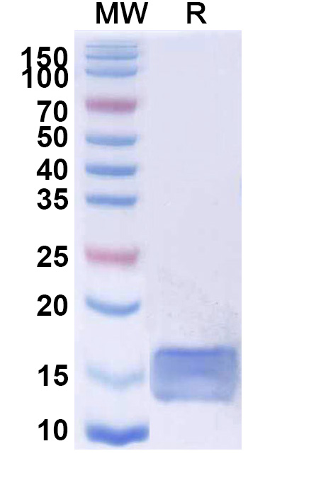SDS-PAGE for Anti-SARS-CoV-2 S Protein VHH (SAA0964)