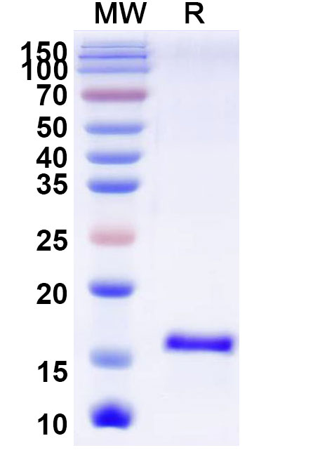 SDS-PAGE for Anti-SARS-CoV-2 S Protein VHH (SAA0965)