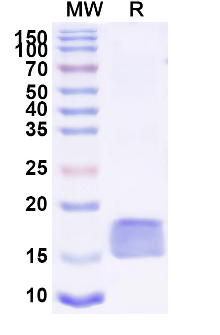 SDS-PAGE for Anti-SARS-CoV-2 S Protein VHH (SAA0967)