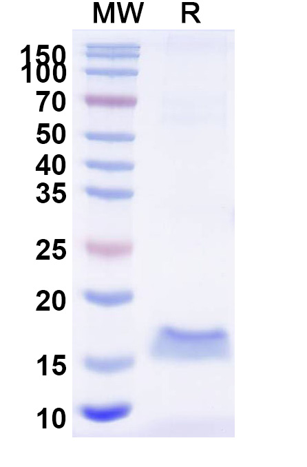SDS-PAGE for Anti-SARS-CoV-2 S Protein VHH (SAA0968)