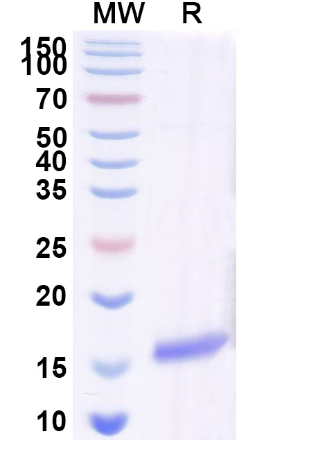 SDS-PAGE for Anti-SARS-CoV-2 S Protein VHH (SAA0969)