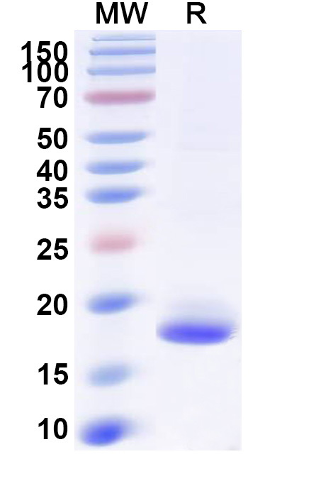 SDS-PAGE for Anti-SARS-CoV-2 S Protein VHH (SAA0970)