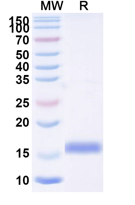 SDS-PAGE for Anti-SARS-CoV-2 S Protein VHH (SAA0989)