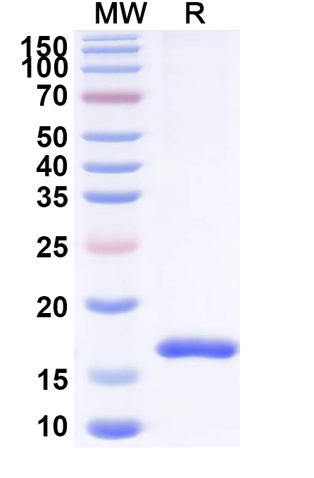 SDS-PAGE for Anti-SARS-CoV-2 S Protein VHH (SAA1022)