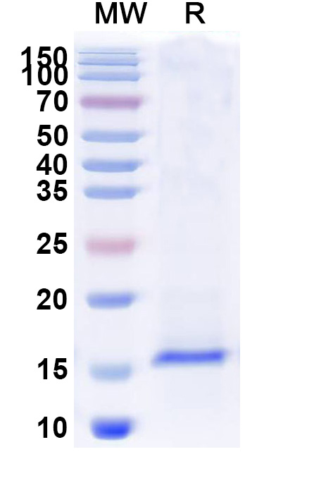 SDS-PAGE for Anti-SARS-CoV-2 S Protein VHH (SAA1043)