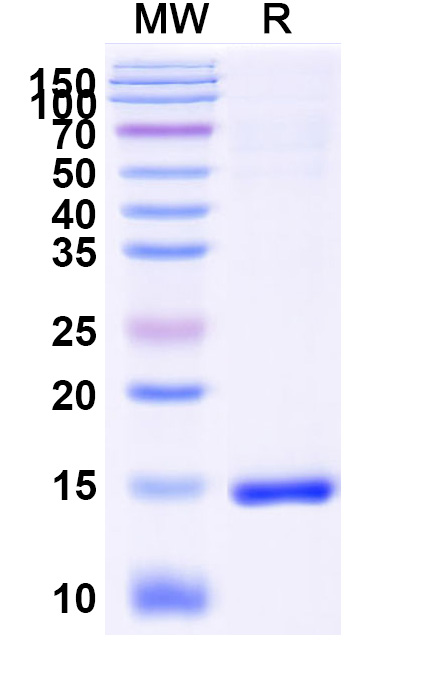 SDS-PAGE for Anti-SARS-CoV-2 S Protein VHH (SAA1048)