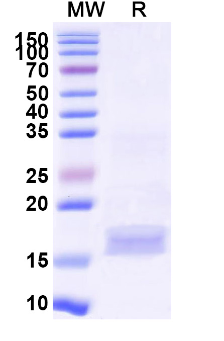 SDS-PAGE for Anti-SARS-CoV-2 S Protein VHH (SAA1049)