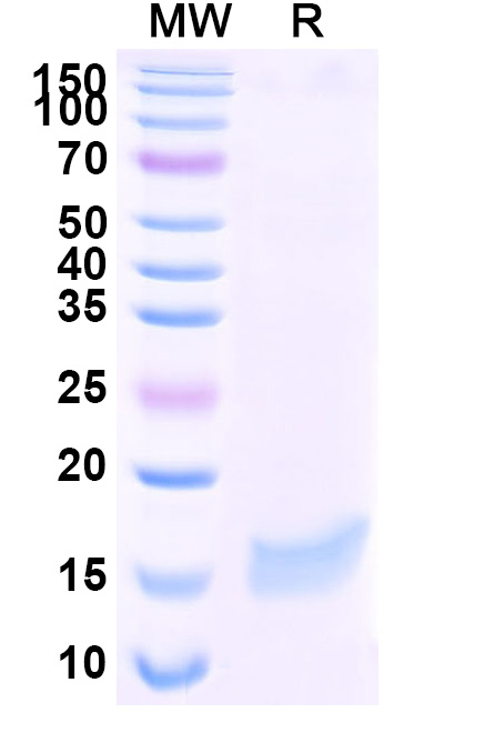 SDS-PAGE for Anti-SARS-CoV-2 S Protein VHH (SAA1058)