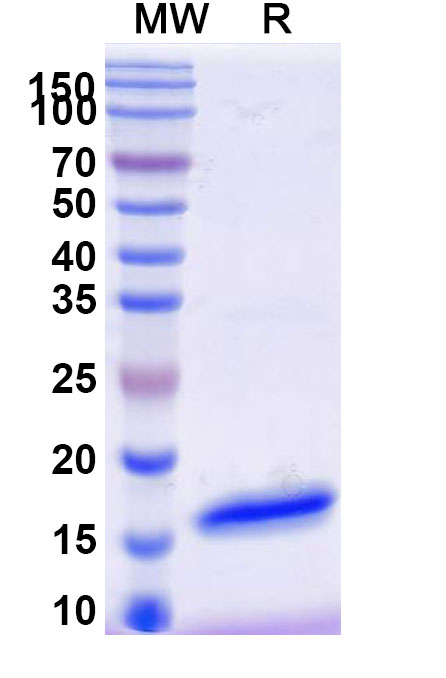 SDS-PAGE for Anti-SARS-CoV-2 S Protein VHH (SAA1059)