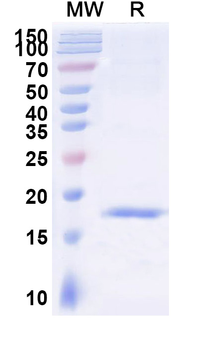 SDS-PAGE for Anti-SARS-CoV-2 S Protein VHH (SAA1061)