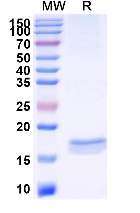 SDS-PAGE for Anti-SARS-CoV-2 S Protein VHH (SAA1067)